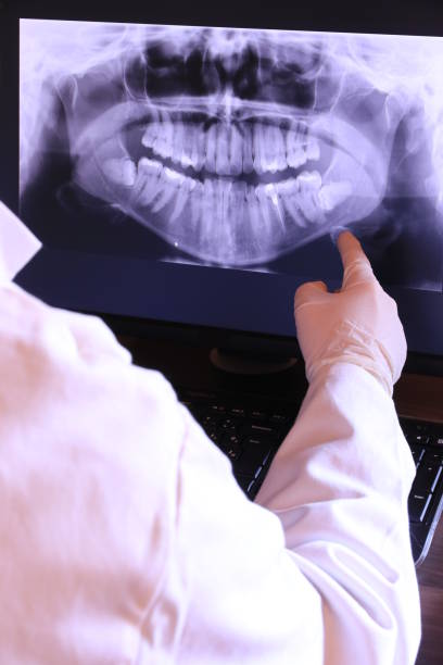 Best Emergency Treatment for Dental Infections or Abscesses in Chino Hills, CA